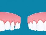 عندما لا يكون  تقويم الأسنان هو العلاج الكافي